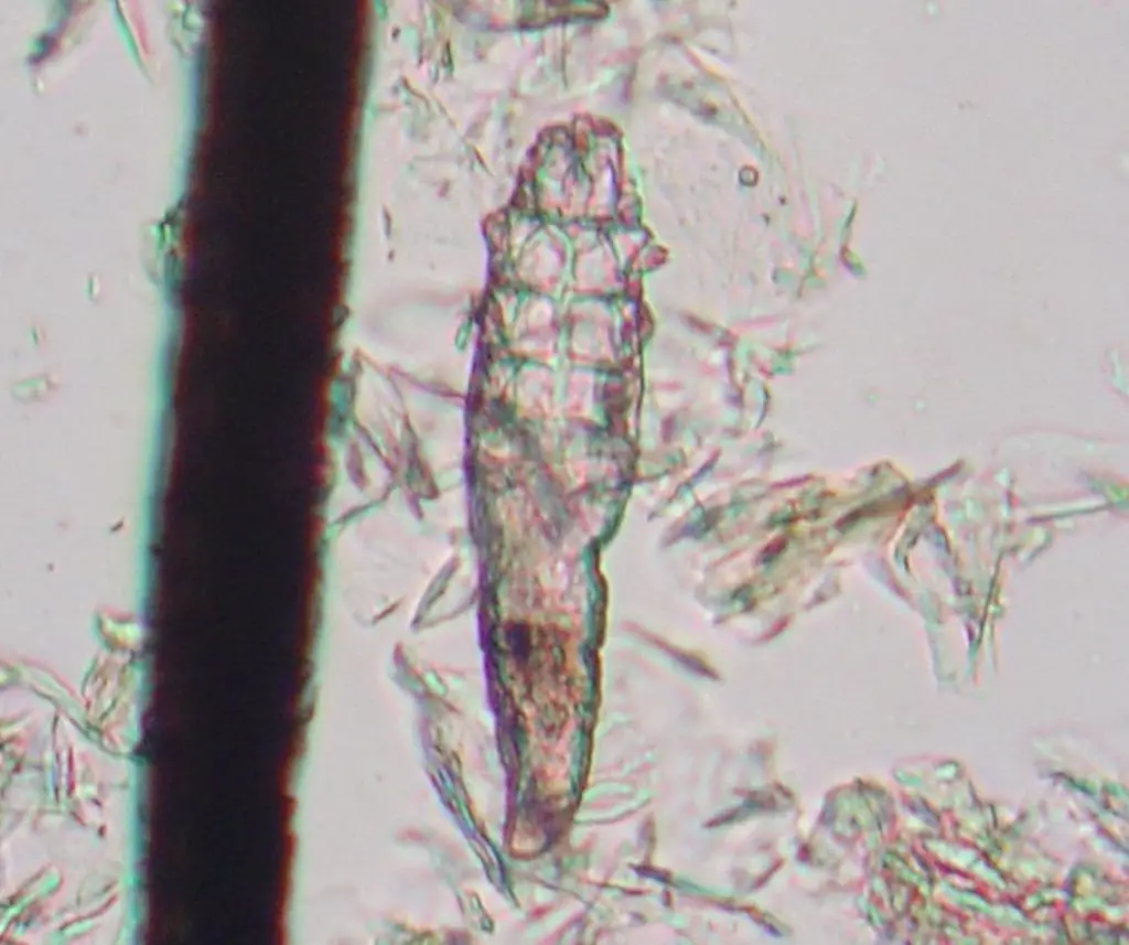 Demodex Canis - Dog Mite